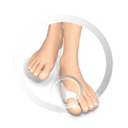 RUCK Silikonowy ochraniacz na Hallux Valgus - 0chrona i komfort, 4 szt