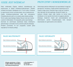 RUCK® basic orteza skórzana na palec młotkowy, duża, lewa, 2 szt.