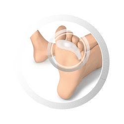 RUCK® smartgel osłona na palce młotkowate 20 mm - 4 szt.