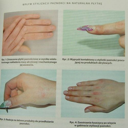 The book - Dermatology for nail designers